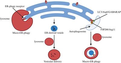 Endoplasmic reticulum stress and quality control in relation to cisplatin resistance in tumor cells